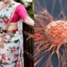 Petticoat Cancer (Saree Cancer): Causes, Symptoms, Prevention & More